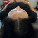 채도스칼프 이미지