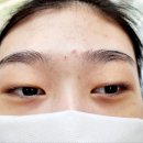 엘뷰티아이