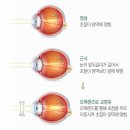 아이케어안경원 이미지