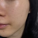 하얀피부 | 기미크림 미백크림 추천 닥터슈크리에이티브 하얀토마토크림 광채피부 후기