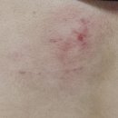 이모국수 이미지