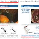 넥스트 메디칼 | 넥스트바이오메디컬(2편) ㅡ Nexpowder, '지혈제'가 아니라 '예방제'로 보는 이유