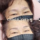 엠보디아 네이버블로그