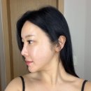 라임 | 신논현피부과 이중턱 울쎄라피프라임 후기, 턱선 변화 제대로 느낀 리얼 경험 후기