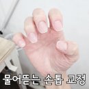 도촌로 8번길 | 분당 도촌동 물어뜯는 손톱 교정 3회차 마지막 전후 비교 후기 네일&amp;스킨 도촌점