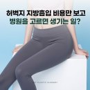 허벅지지방흡입비용만 보고 병원을 고르면 생길 수 있는 일