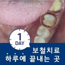 위즈치과기공소 네이버블로그