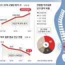 스트레스 풀려고 먹는 매운 음식, 골치 아픈 고혈압 유발 이미지