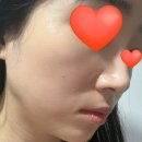 덕인리프트 | 내돈내산 뷰티디바이스 홈모드 써마 리프트 10주차 후기