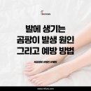 레푸스 다산