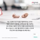 고려보청기(독일지멘스) 이미지