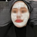 인천 주근깨 레이저 고민 끝, 구월동 주근깨 통증 적은 시술 후기