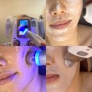 수(水)피부 이미지
