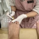 내성발톱발톱무좀관리김수정뷰티 이미지