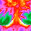 FDA 승인, 비방사선, 비접촉 유방 검진 적외선 열화상 검사란 무엇입니까? 이미지