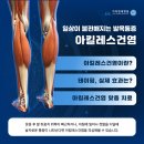 아킬레스건염 테이핑, 발목 통증 완화에 효과 있을까? 이미지
