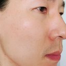 태양약품 | 민감성 피부 크림찾는다면 &#39;일양약품 닥터 프리메틱&#39;, 민감피부도 진정되는 기능성 크림 후기!