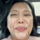 (주)씨젠 | 씨젠 지연성 알러지 검사IgG 후기(음식물과민증검사)