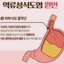 내향인이나 HSP가 커피를 끊어야 하는 이유 이미지