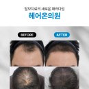 헤어온의원 이미지