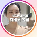 쥬베룩 볼륨 2회차 후기 이마꺼짐 + 팔자주름 제거