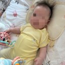 남양주눈밑꺼짐 잼버실리프팅 4줄 받은 후기(내돈내산) 아가방 백일아기선물 소금빵포장