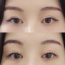 하대동380 | 진주 혁신도시 크라운연장 참뷰티 시술 후기!!