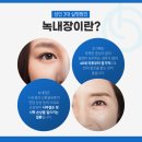 밝은희망안과의원 이미지