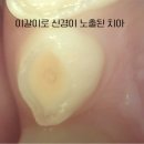 하단 턱편한 미소 치과의원 | 밤마다 들리는 '뽀드득' 소리, 우리 아이 이갈이 정말 괜찮을까? [성남어린이치과]
