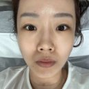 (주)129메디컬 | [부산] 사하구피부관리 ‘거대토끼토탈뷰티’ 콜드플라즈마 후기