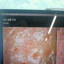 휴먼에스테틱 | 달서구피부관리 잘하는 곳 휴먼뷰티에스테틱 후기 ✌️