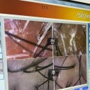 탑케어 - 유성구 원신흥남로27번길 15 | 천안두피관리 탑스칼프 천안점 지루성 두피 케어 받은 리얼후기