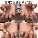 네일신드롬 네이버블로그
