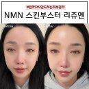 강남준성형외과의원 | [강남] NMN 스킨부스터 리쥬엔ㅣ킴카다시안도하는 저속노화 피부관리ㅣ강남역성형외과 방문 후기
