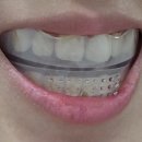 덴탈스페이스 이미지