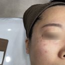 그리니피부과의원 이미지