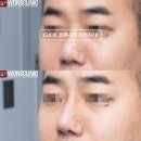 하이코코 이미지