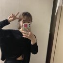 정보, 노블앤코 비절개 보조개 수술 내돈내산 2년 지난 후기_가격_비용
