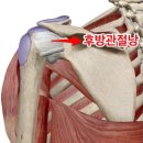 노블골프헬스 | 어깨 수술 후 회복 운동! (Feat. 회전근개 &amp; 극상근) [용호동PT 용호동피티 용호동헬스 노블짐PT샵]