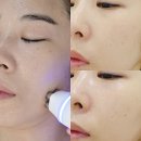 바디메뉴얼 | 도마동 피부관리 휴담 스킨앤바디 샵의 온결케어 후기