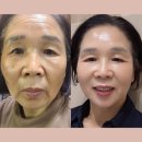 (주)올바른팜 | 세수하고 피부가 더 촉촉해? "모공 95% 청소?" 인셀덤 ICD 밸런싱 젤 클렌저로 완성하는 깐달걀 피부...