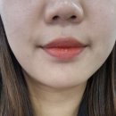 동탄오라클피부과의원 이미지