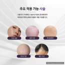 대구 미라젯,미라젯 스킨부스터,미라젯 후기,하이퍼럭스 후기