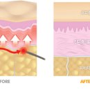 블루밍의원 이미지
