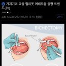 요즘 헐리웃 여배우 성형 트렌드 이미지