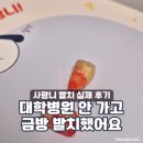 이사랑치과의원 | 매복 사랑니 발치 리얼 후기! 비용 아끼는 사랑니 치과 선택 꿀팁