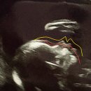 뉴플랜여성의원 이미지