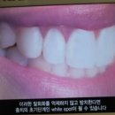 하이덴치과 네이버블로그
