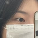 아이지케어