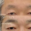 밀라뷰티 대구본점 네이버블로그